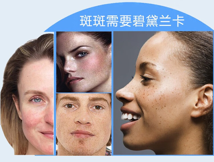 NHFOUYOU祛斑精华油点黑点玫瑰净颜精油补水美白提亮肤色溶斑精华美白淡斑 1瓶【体验装】