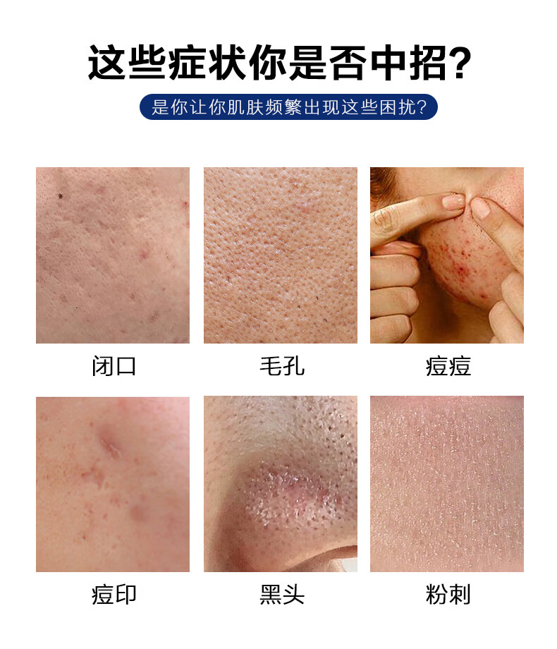 雅公主壬二酸15%凝胶水杨酸细致毛孔霜收缩毛孔任清洁黑头闭口粉刺30ml