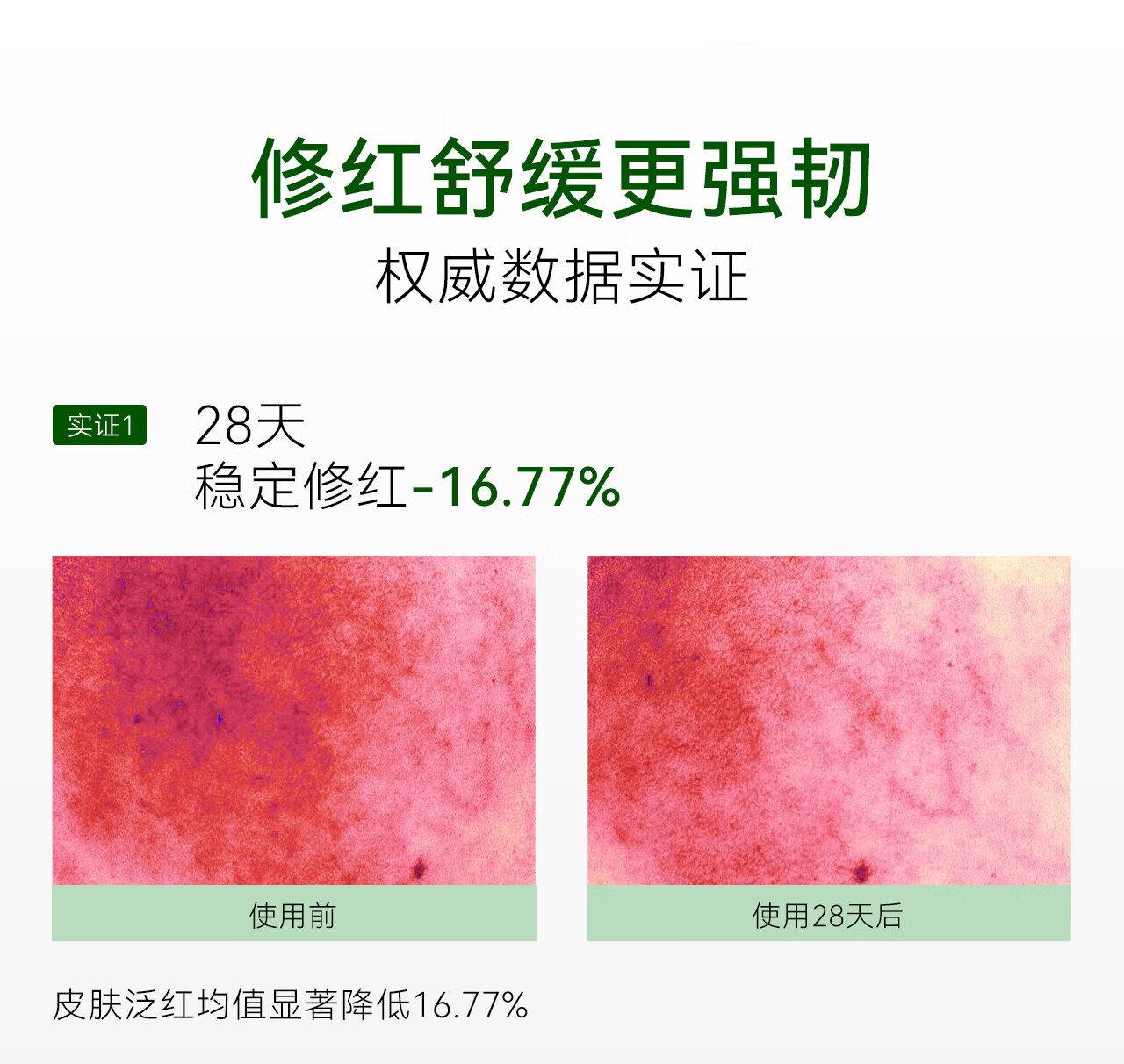 安修泽油橄榄精华水150ml 补水保湿干皮油皮女护肤精华爽肤水