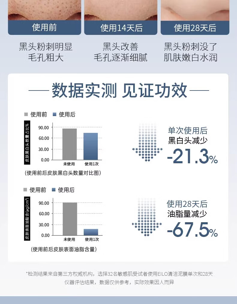 清可颜亚马逊eilo泥膜白泥清洁面膜涂抹式清洁毛孔去黑头男女通用100g
