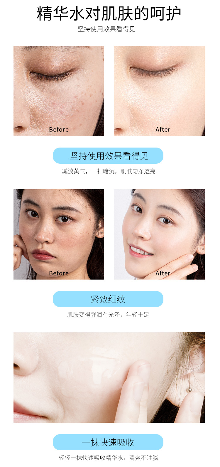 雪玲妃 爽肤水女补水保湿收缩毛孔护肤水清爽精华水 玻尿酸补水保湿 精华爽肤化妆水