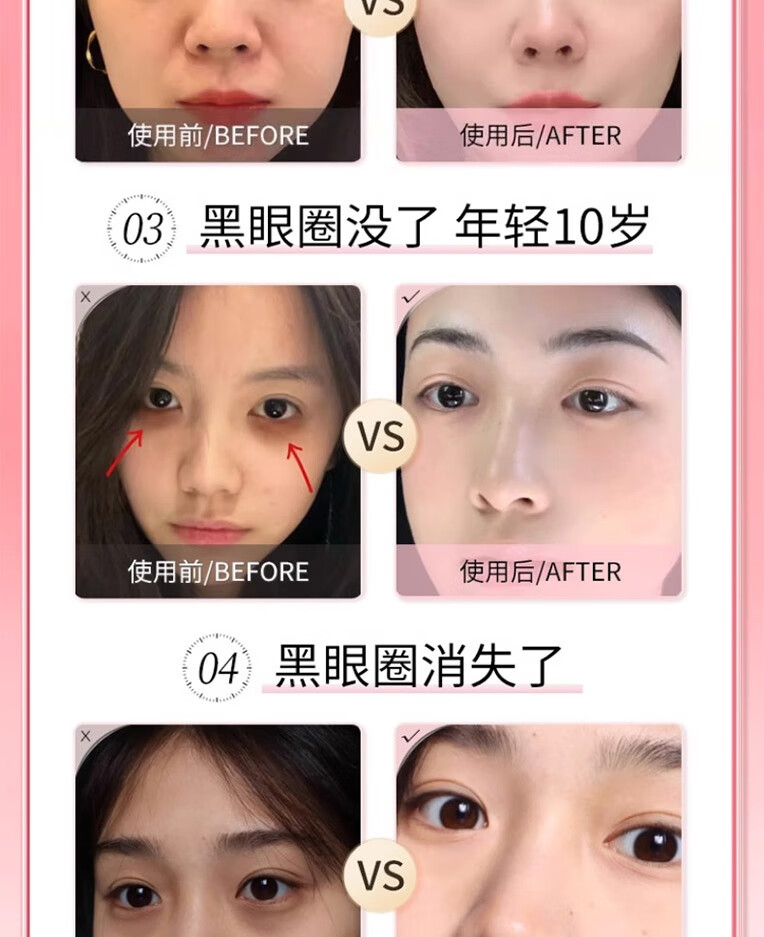 莘护南京同仁堂类蛇毒肽眼霜淡化细纹提拉紧致黑眼圈眼袋脂肪粒补水