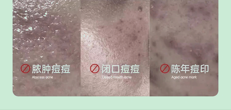 仕月油橄榄祛痘精华液面部舒缓补水改善敏感肌泛红面部精华30ml