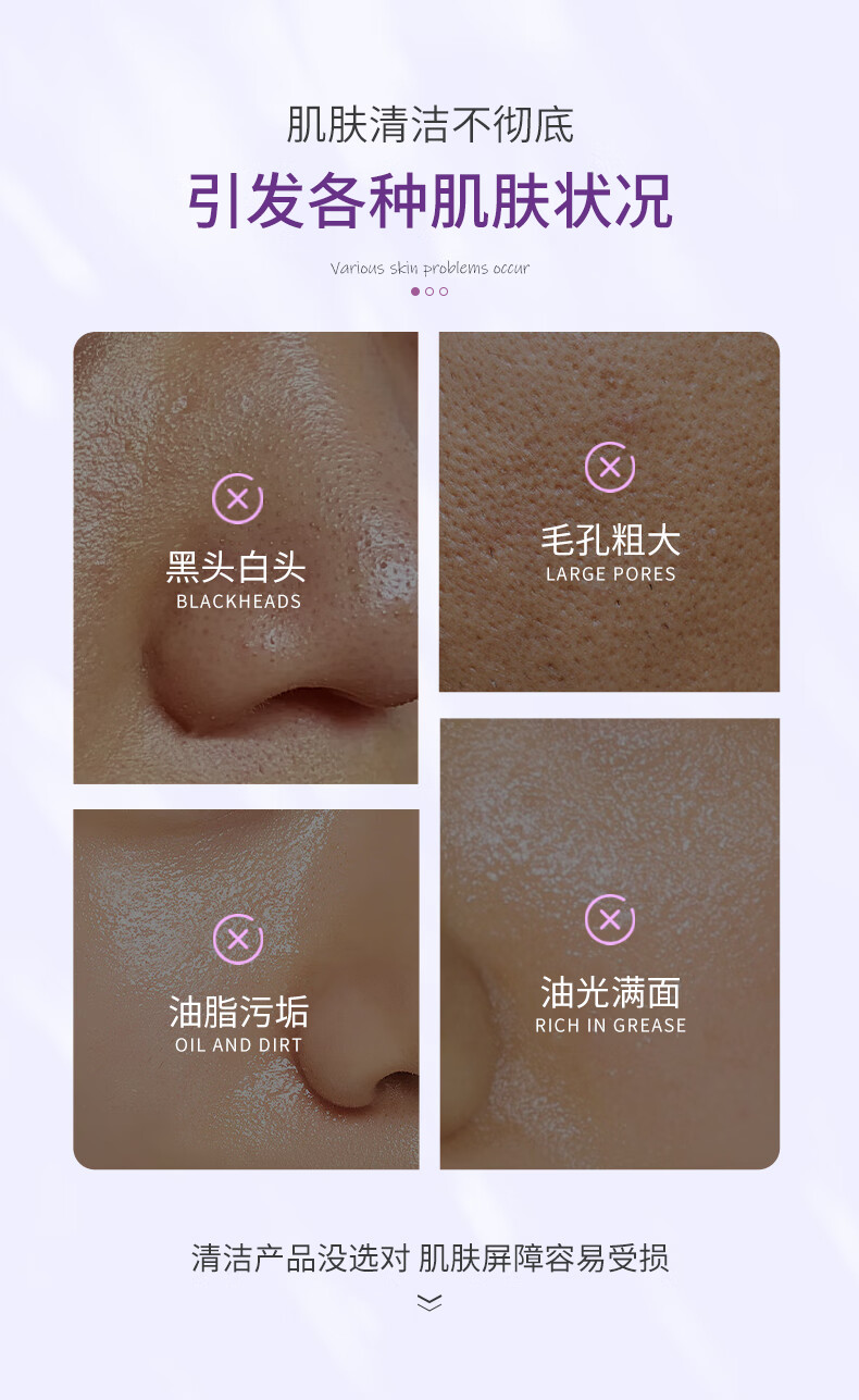 Maigoole 毛孔排出脏东西 去淡化黑头粉刺收缩淡毛孔清洁泥膜男女