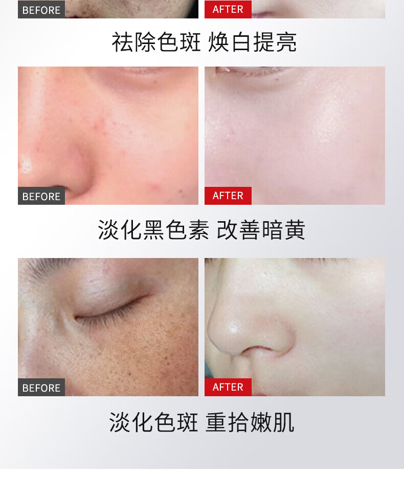 BEOTUA【特证祛斑】肤研美白祛斑霜淡化去斑霜男女20g