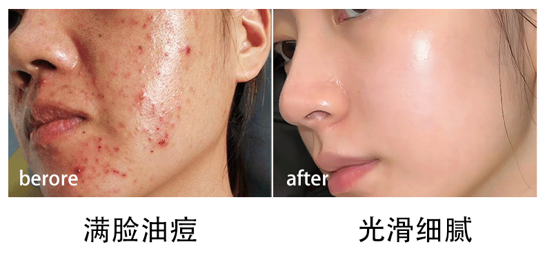 雪柔雅氨基酸洗面奶女温和深层清洁保湿补水控油平衡洁面乳男青少年