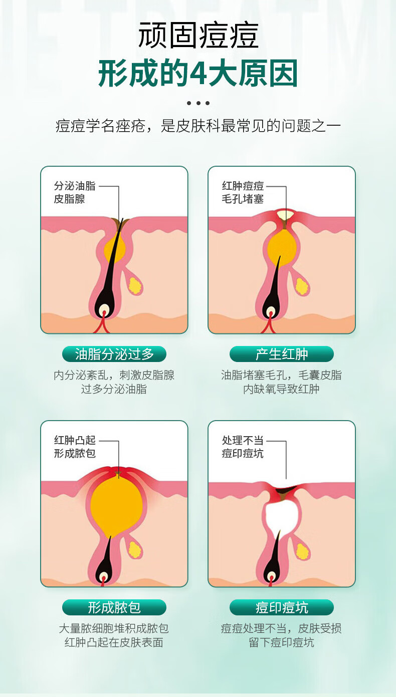 同仁堂祛痘膏淡化痘印痘疤痘坑修护痘肌闭口粉刺青春痘去痘痘和痘印20g