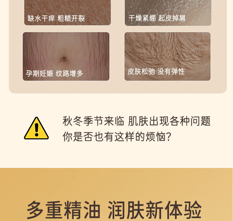 诗宁Shing淡纹精油身体油护理秋冬滋润保湿抗皱身体精华油按摩油 1瓶/100ml