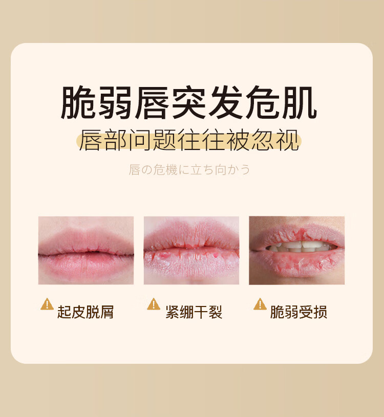 玛朴缇maputi倍润嘟嘟护唇膏4g 润唇膏女 保湿滋润淡化唇纹去唇周黑