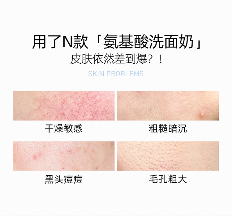 莱仕（LARSO）氨基酸洗面奶洁面乳 深层清洁控油收缩毛孔敏感肌男女适用100g