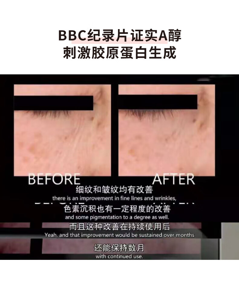 HBN颈霜视黄醇维A醇颈纹霜淡纹补水保湿提拉紧致护肤女神节礼物女友