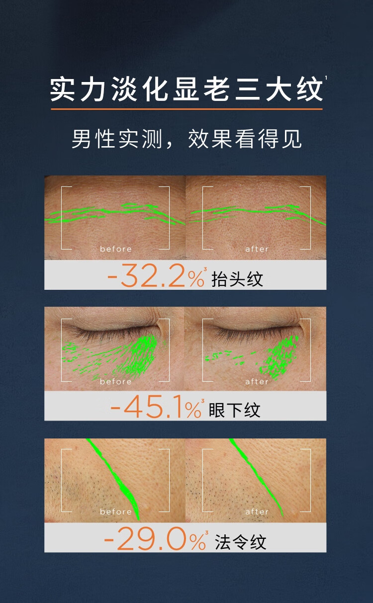 欧莱雅男士【308抢先购】青春肌源玻色因淡纹霜50ml抗皱面霜护肤品礼物