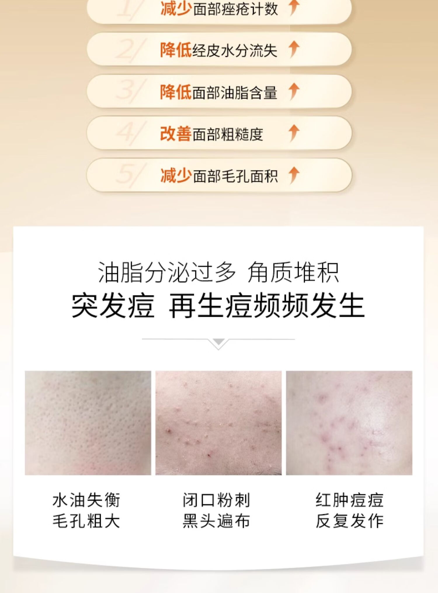 若美欣杏仁酸5%精华30ml祛痘壬二酸衍生物控油去角质去闭口粉刺