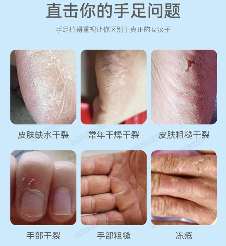 苏泉马油棒棒油擦手的马牌润面油马油膏防裂膏手足干裂官方可搭蛤蜊油