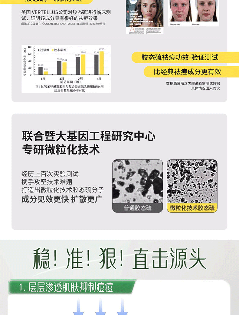 韩伦美羽胶态硫祛痘大灯泡精华液控油去痘闭口粉刺痘印痘坑提亮肤色 