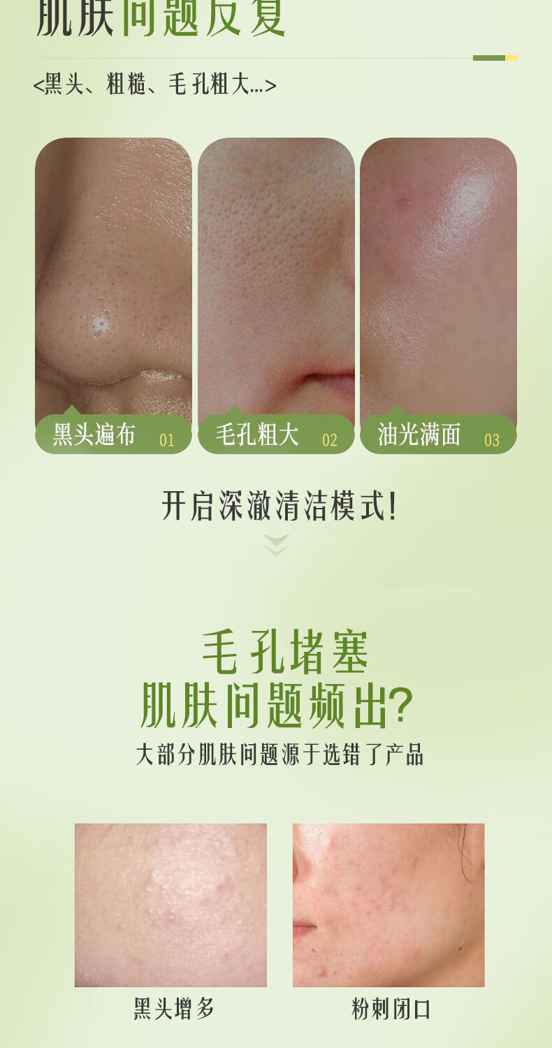 倾龄牛油果泡泡面膜复合酸去黑头粉刺深层清洁毛孔积雪草收缩毛孔yabi