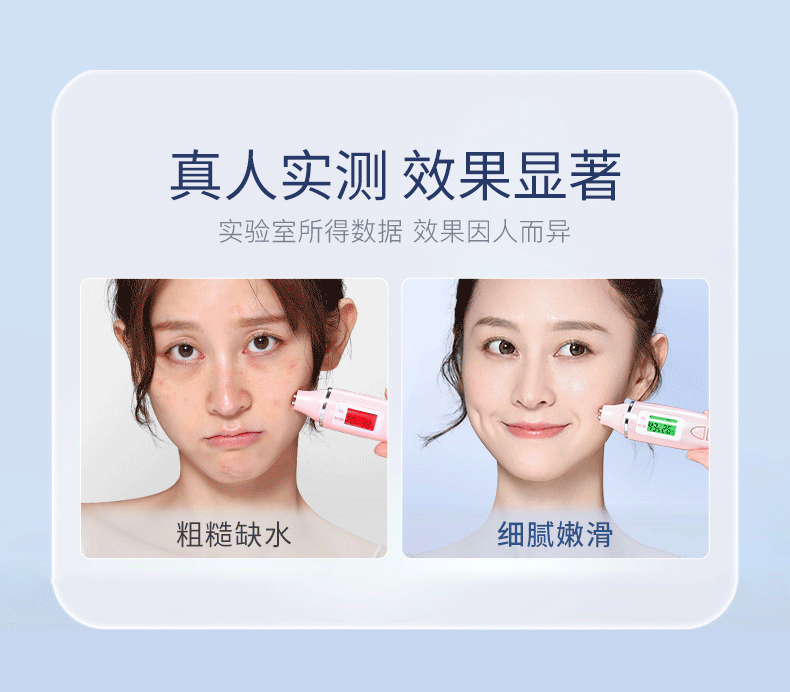 可福佳敏感肌面膜护肤品红血丝屏障受损修护脸部泛红舒缓补水 25ml*10片