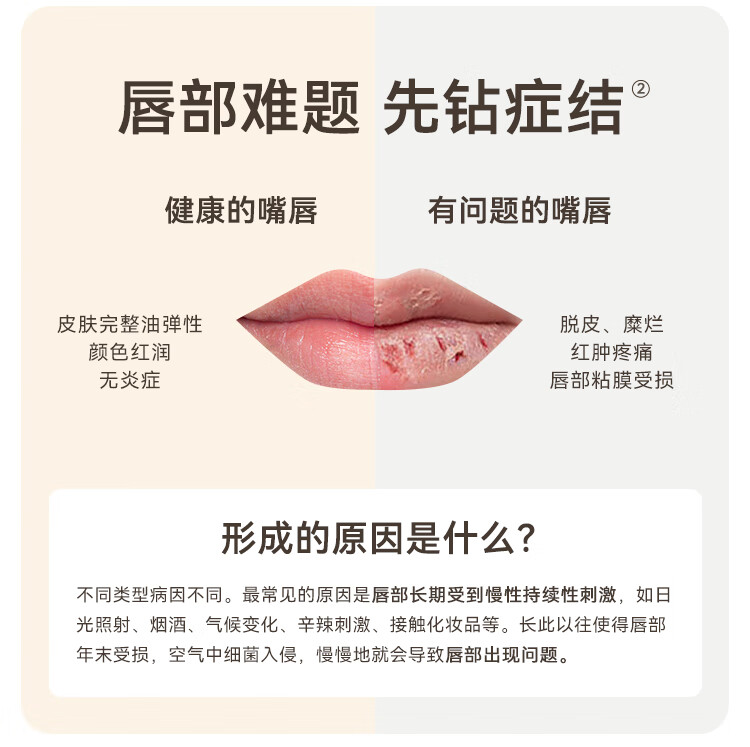 净舟三草油唇膏保湿唇滋润炎补水淡纹唇膜非医男女唇炎用38好礼送女友