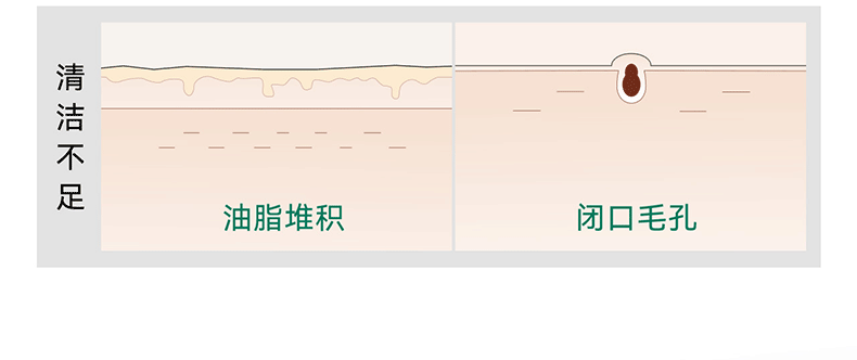 安修泽安修泽油橄榄净肤舒润洁面乳敏感肌男女控油 40g
