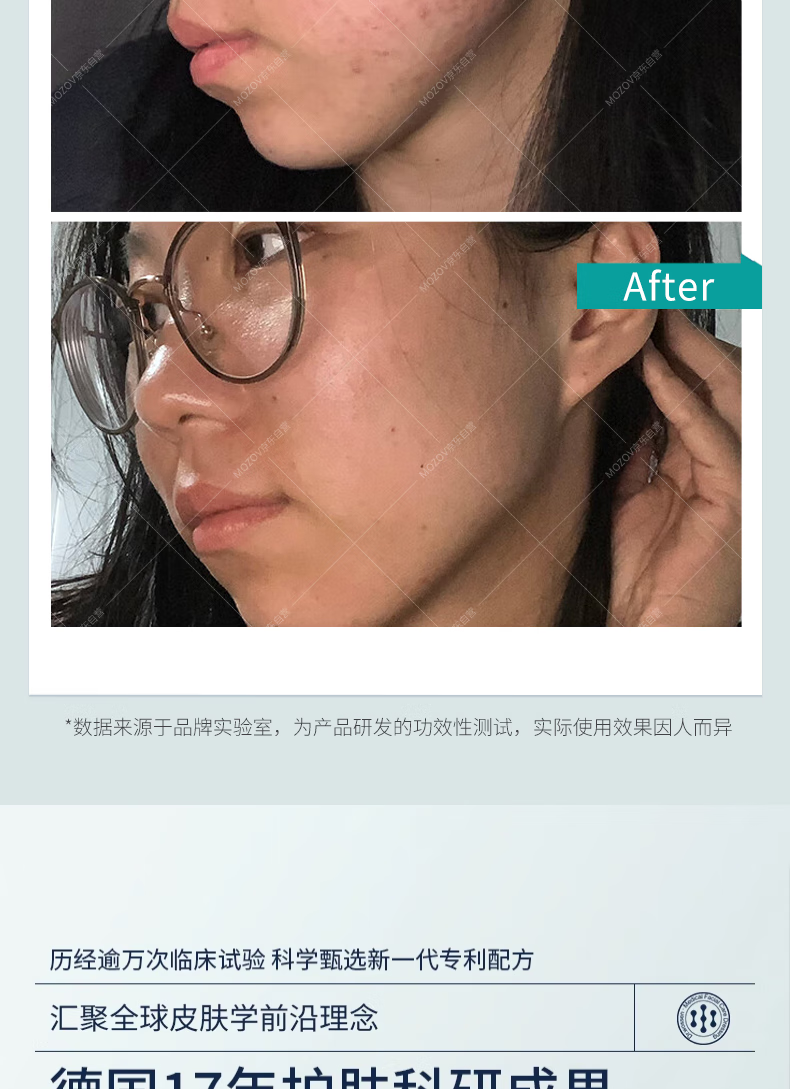 ANFANY痘痘点涂棒精华液水杨酸修护痘改善肌闭口粉刺痘印痘坑20支/盒