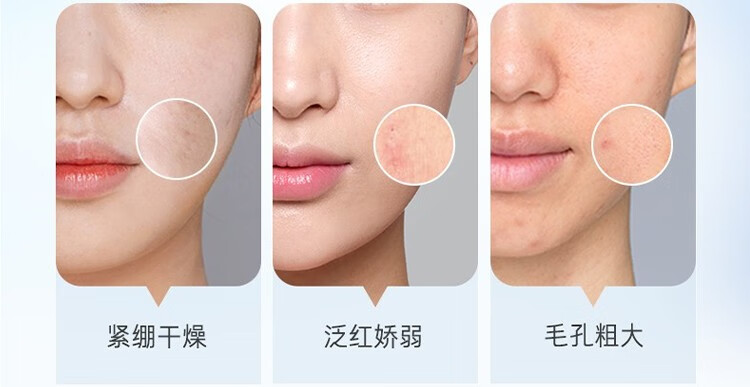 兰芝（LANEIGE）水衡透润润肤乳50ml*3 中小样，介意慎拍 面部护肤女士乳液