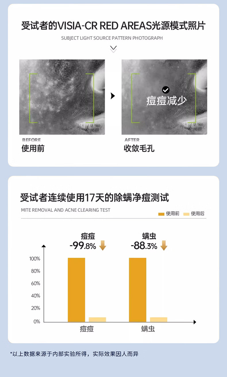 美嘉秀洗面奶补水保湿深层清洁抗痘控油温和氨基酸洁面乳除螨男女通用
