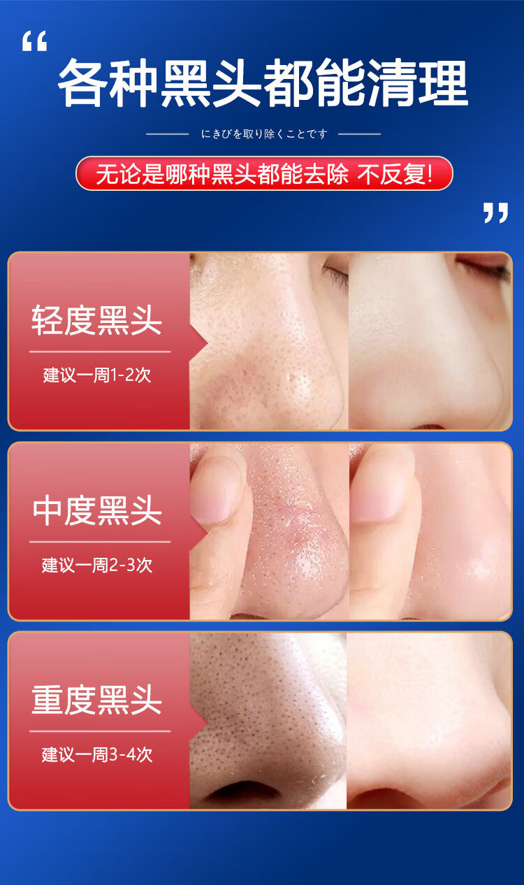 百鹿汇去黑头撕拉面膜男女通用祛粉刺死皮清洁油脂收缩毛孔120g