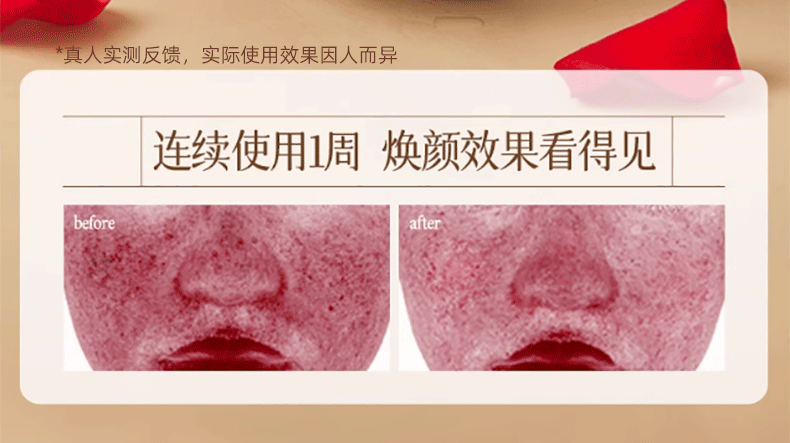 BEAI玫瑰纯露大马士革爽肤水湿敷水保湿提亮暗沉收毛孔玫瑰精华 500ml