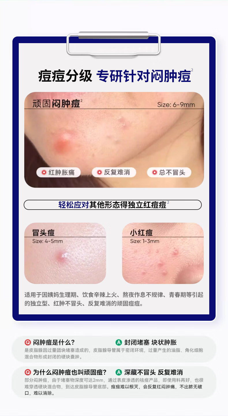 AOPY草本净颜祛痘膏修护青春痘祛痘闭口粉刺痘印痘坑学生青春痘30g