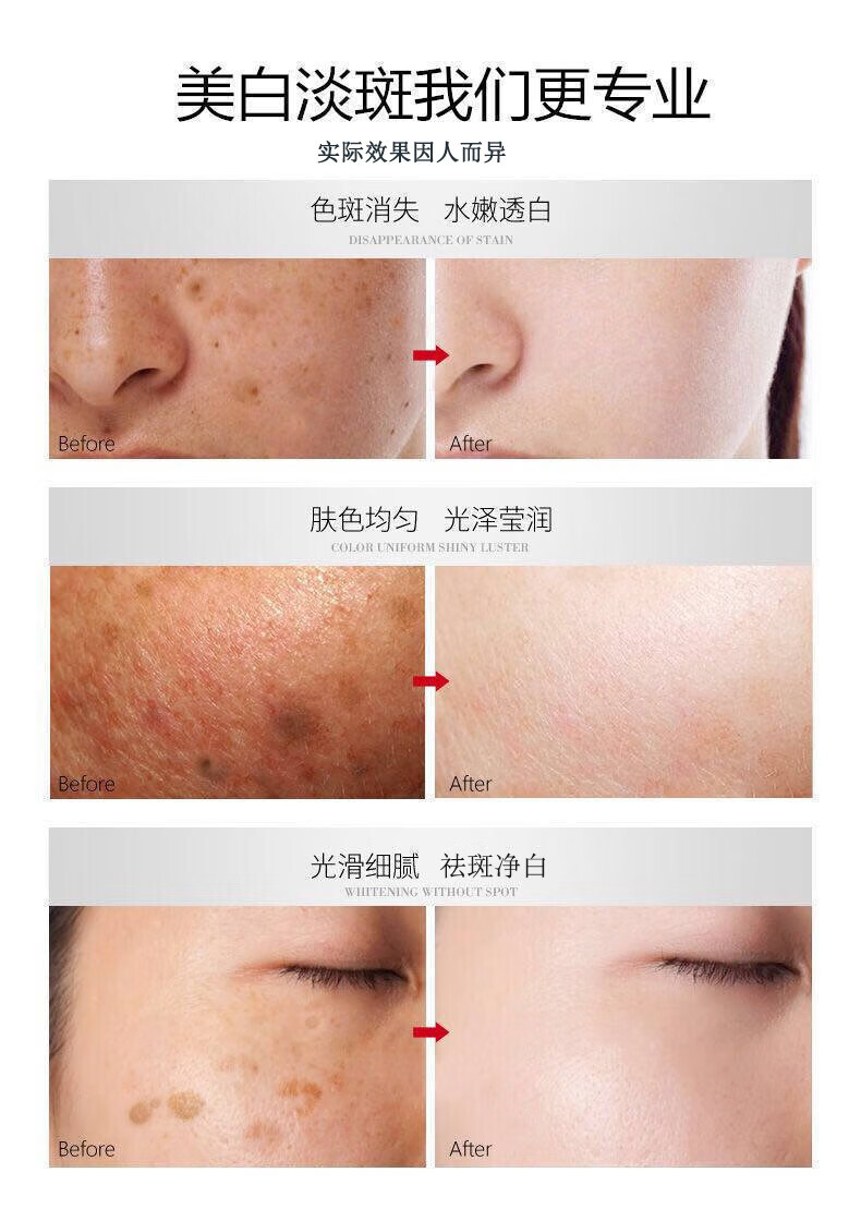 同仁堂美白洗面奶女男祛斑淡斑控油收缩毛孔深层清洁面乳300g