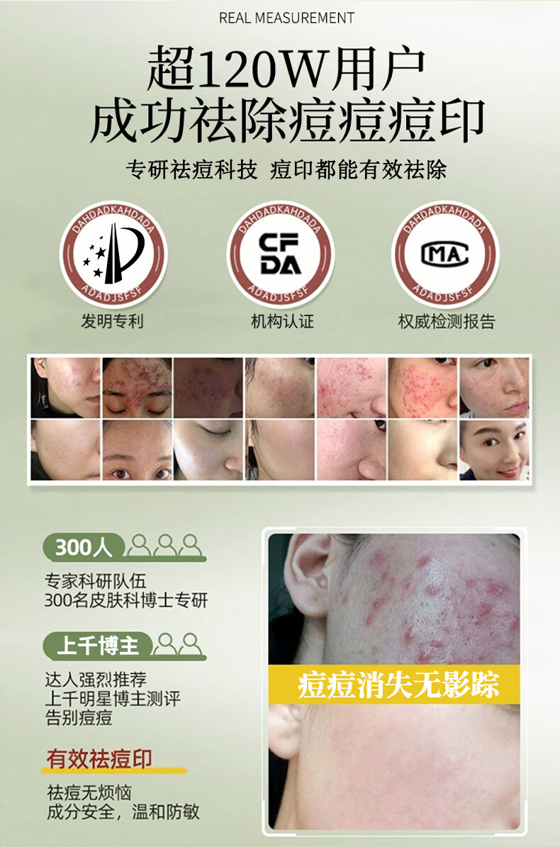 丽可植小绿瓶祛痘精华液痘印淡化痘印祛痘祛黑头收缩毛孔闭口粉刺霜 【1瓶】祛痘体验装