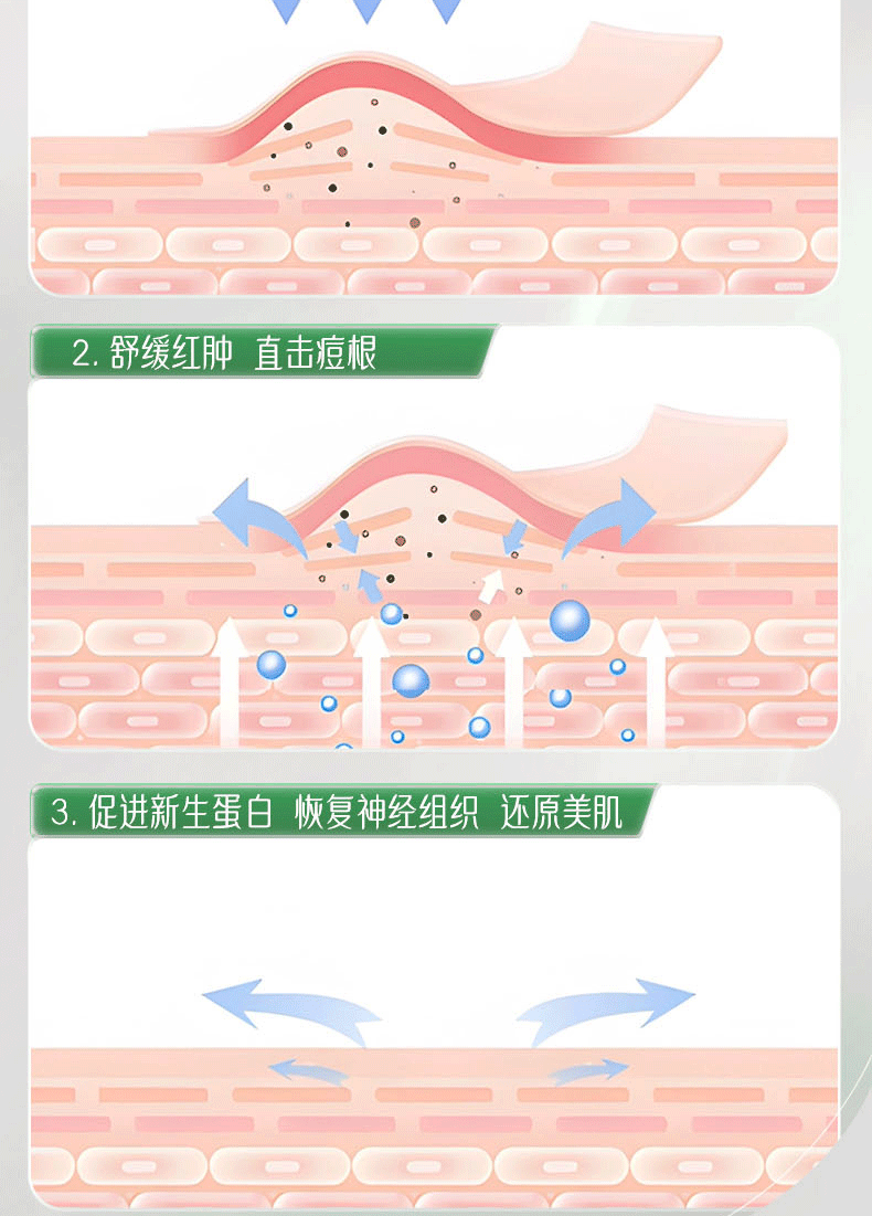 韩伦美羽胶态硫祛痘大灯泡精华液控油去痘闭口粉刺痘印痘坑提亮肤色 