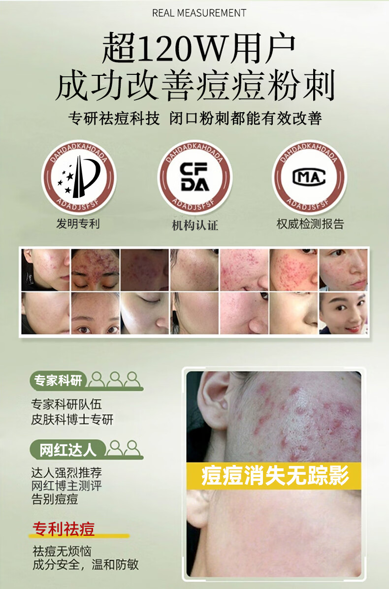 丽可植【官方直售店】小绿瓶祛痘精华液黑头祛痘精华液淡化痘印化妆品 【两瓶】祛痘加强版+水光面膜1片