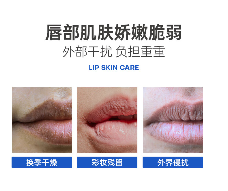 ROPO诺卜3.0唇部精华液啫喱唇膜补水保湿淡化唇纹精华乳10g