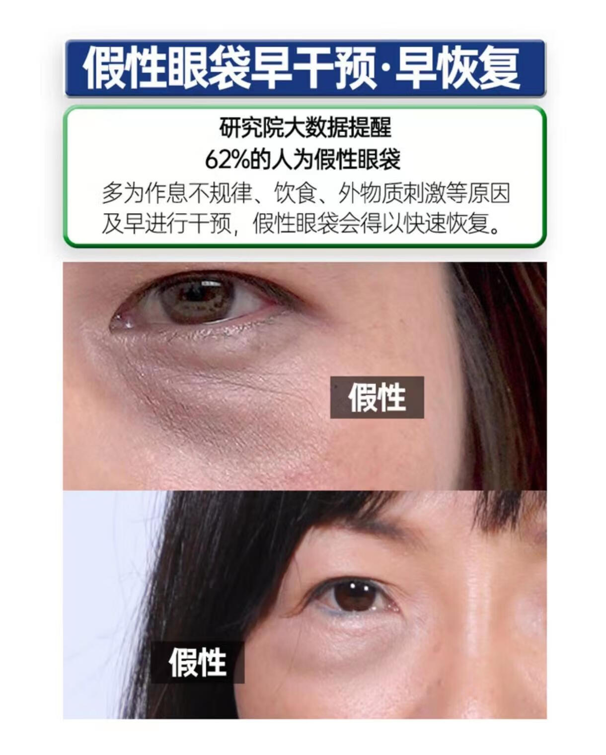 同仁堂类蛇毒眼霜眼袋黑眼圈淡化细纹皱纹提拉紧致补水保湿呵护眼周30g