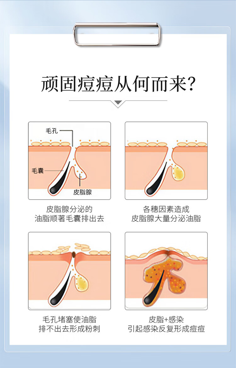 草萨草本祛痘膏消痘印清痘膏淡化痘印男士去痘疤痘坑修复学生青春痘