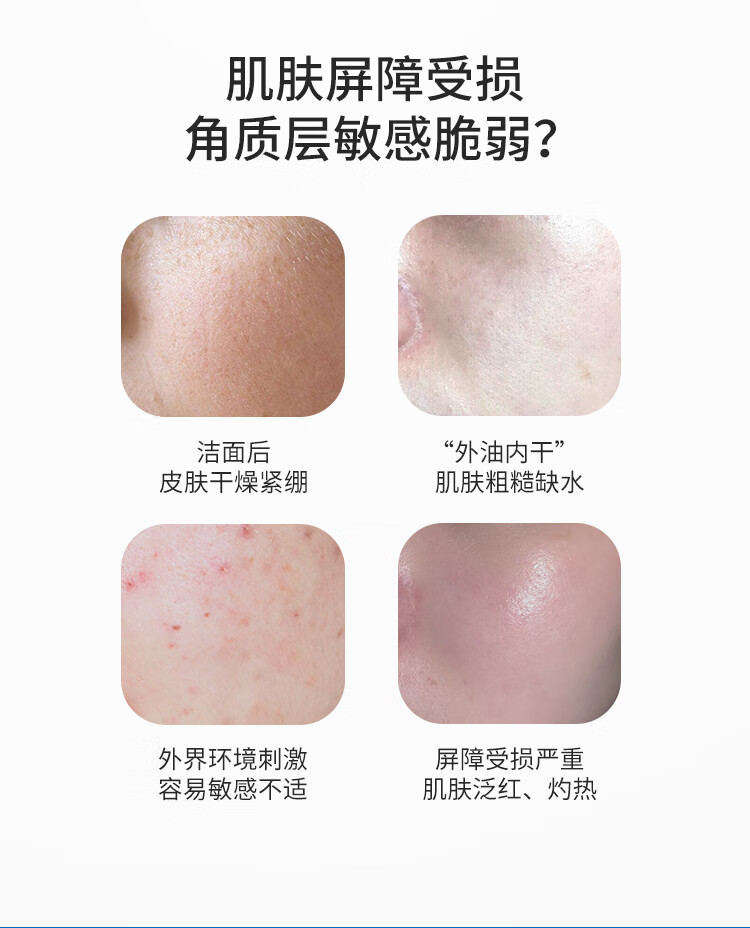 皮宝舒缓柔肤水爽肤修护屏障补水保湿维稳修护礼物送女生 120ml