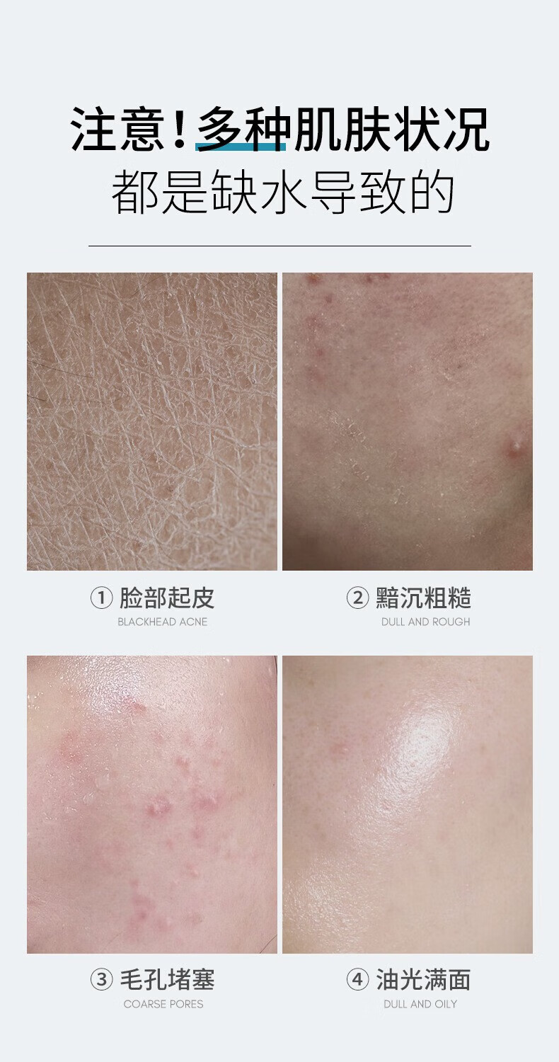 水散维E护肤甘油脸部精华补水保湿清爽不干燥不卡粉男女全身可用1瓶
