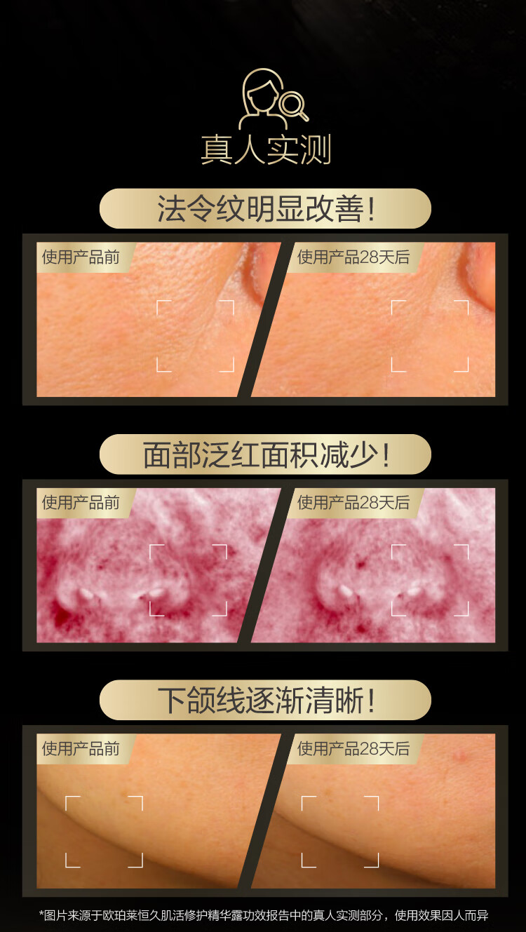 欧珀莱（AUPRES）【唐嫣同款】恒久肌活修护精华露4代30ml  接龙运