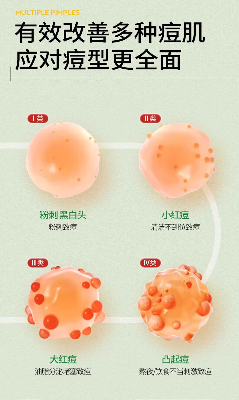 ORGINESE欧橘植萃舒缓祛痘精华液修护痘坑呵护肌肤男女通用30ml礼物女
