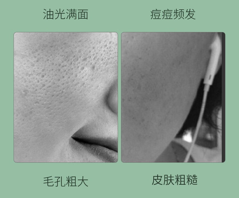 馥珮细致毛孔均衡爽肤水男女补水保湿收缩毛孔油皮清爽化妆水120ml