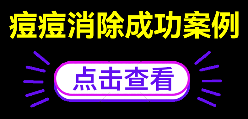 德德维芙壬二酸祛痘膏痘印和痘坑去青春痘学生去黑头粉刺修凹洞男女凝胶膏