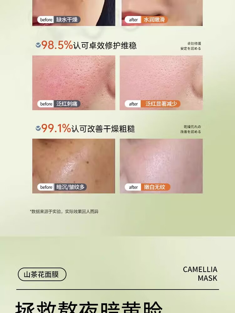 爱兰歌娜山茶花巨补水面膜烟酰胺美白保湿熬夜急救去淡黄斑提亮肤色男女士 山茶花补水面膜 10片 +美白面膜3片 10片/盒