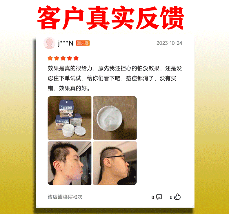 宫本武藏祛痘膏去痘痘面霜修复痘印痘坑淡化青春痘男女学生闭口粉刺10g