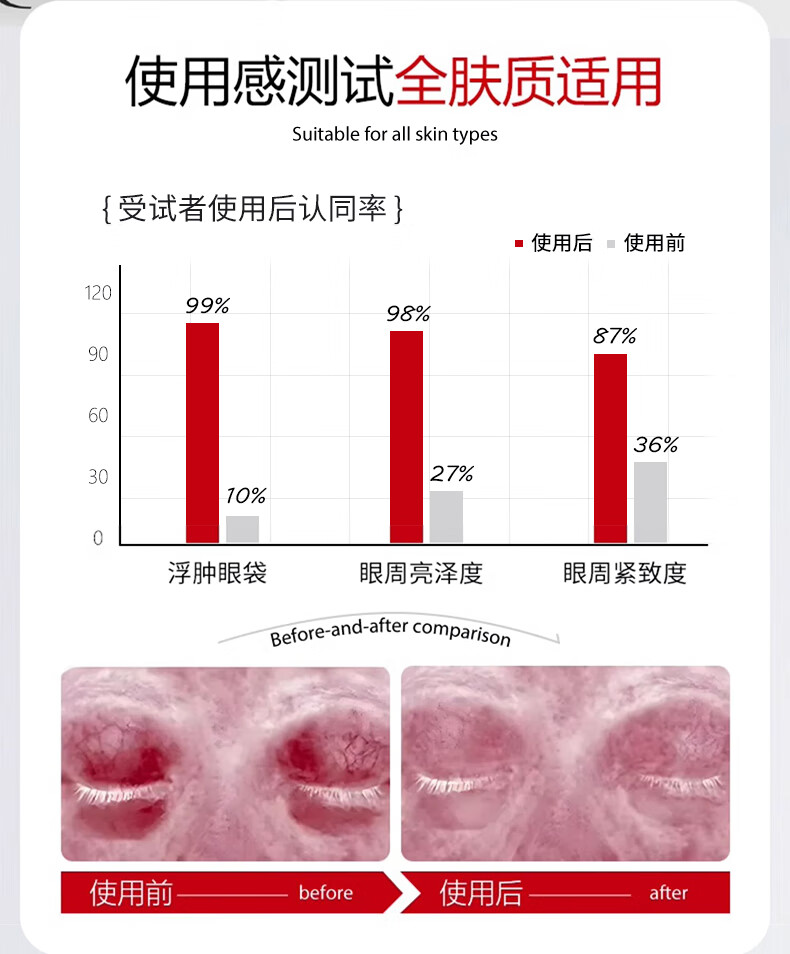 ORGINESE欧橘蛇毒肽眼膜贴淡化眼袋黑眼圈细纹抗皱提拉紧致女补水