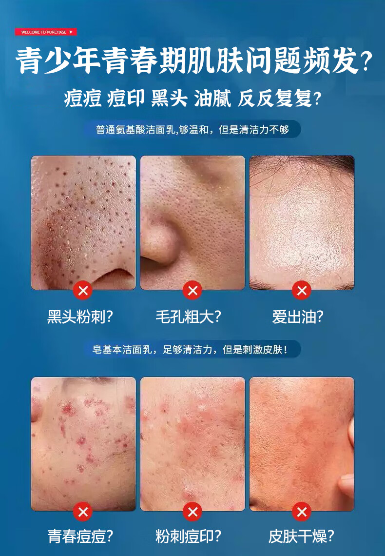 同仁堂祛痘洗面奶青少年洗面奶氨基酸控油黑头粉刺深层清洁青春痘200ml