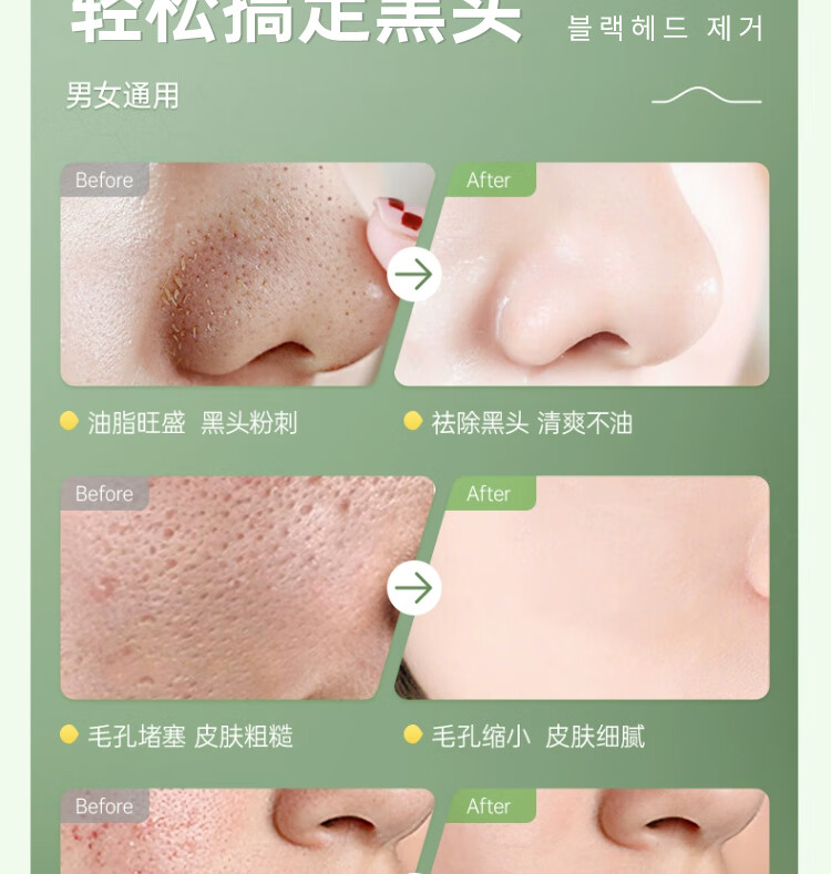 草萨韩国果酸温和黑头导出清洁毛孔收缩毛孔粗大去修复淡闭口男女护肤