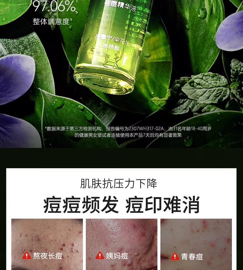AOPY祛痘精华液祛痘淡化痘痘印收缩毛孔保湿皮傲宁水杨酸祛痘精华30ml