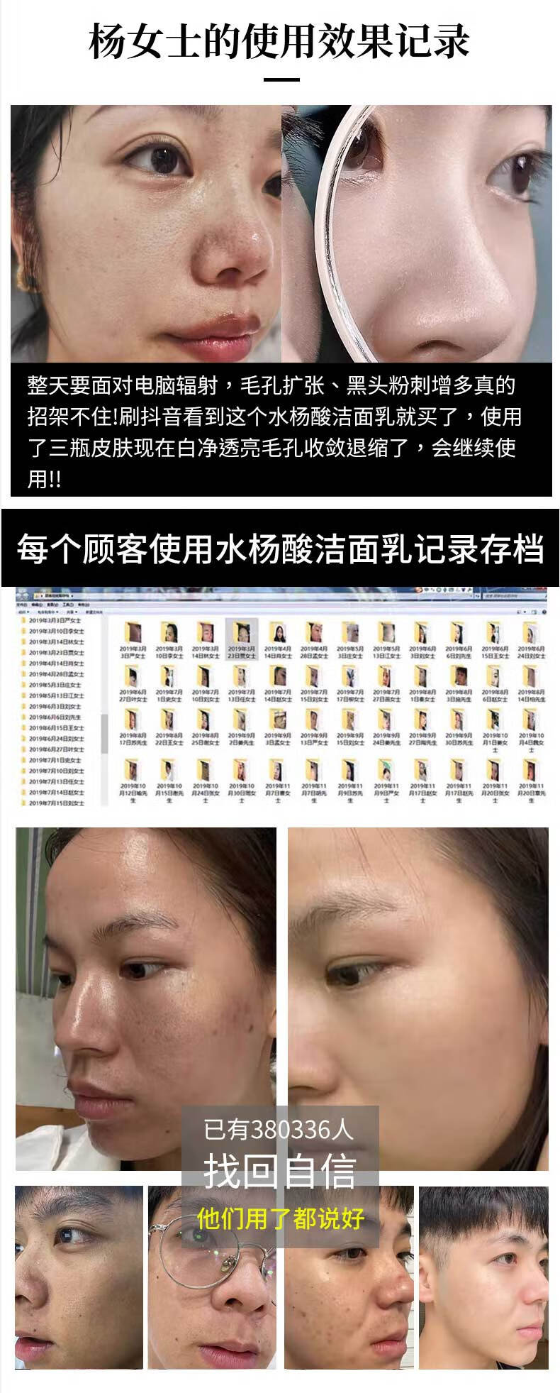 GUEKK维生素b5水杨酸洁面乳去黑头收缩毛孔清洁官控油方旗舰男女通用 2支日常装【清洁黑头粉刺】