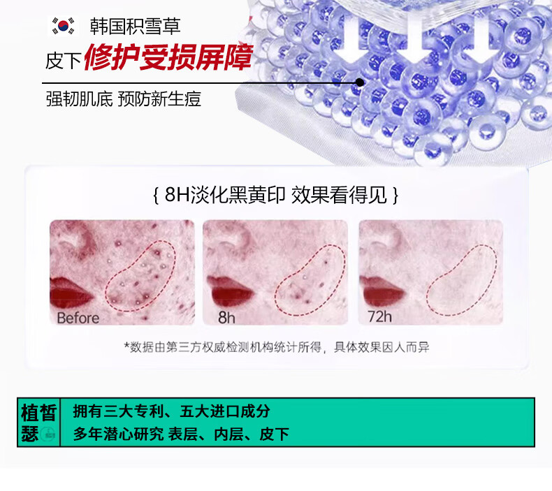 植皙瑟壬二酸祛痘控油精华液控油去痘闭口粉刺痘印痘坑舒缓提亮肤色5支